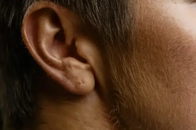 Photograph illustrating How can Auricular Reflexology help?